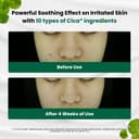 R.E.D Blemish Clear Soothing Cream, 70ml - Image 3