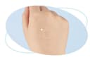Spot Care Patch Kit + Hydrocolloid Band - Image 2