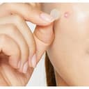 Acne Pimple Master Patch, 24ea*5 - Image 9