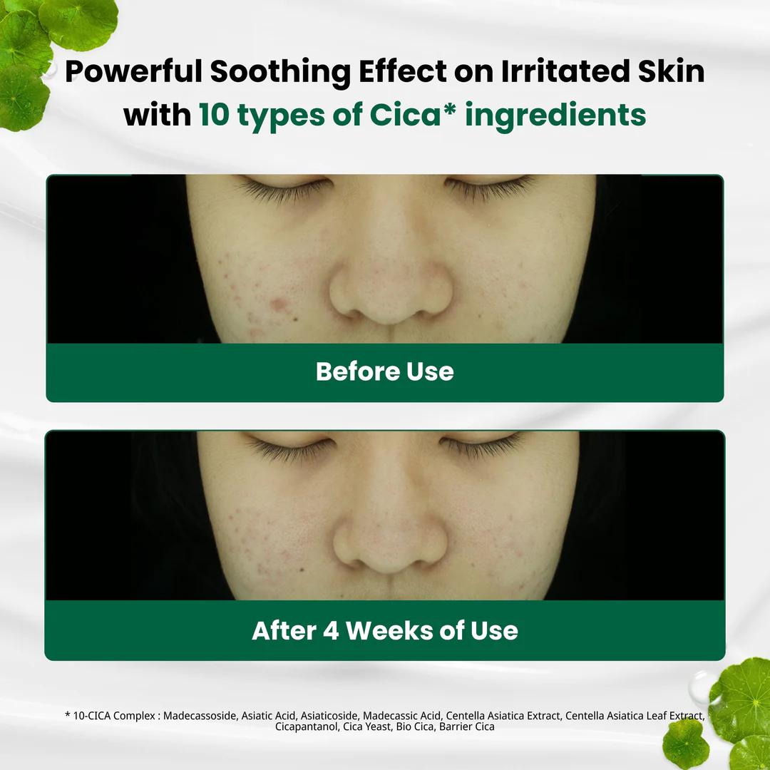 R.E.D Blemish Clear Soothing Cream, 70ml - Image 3