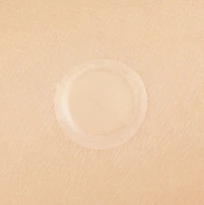 Spot Patch - Image 4