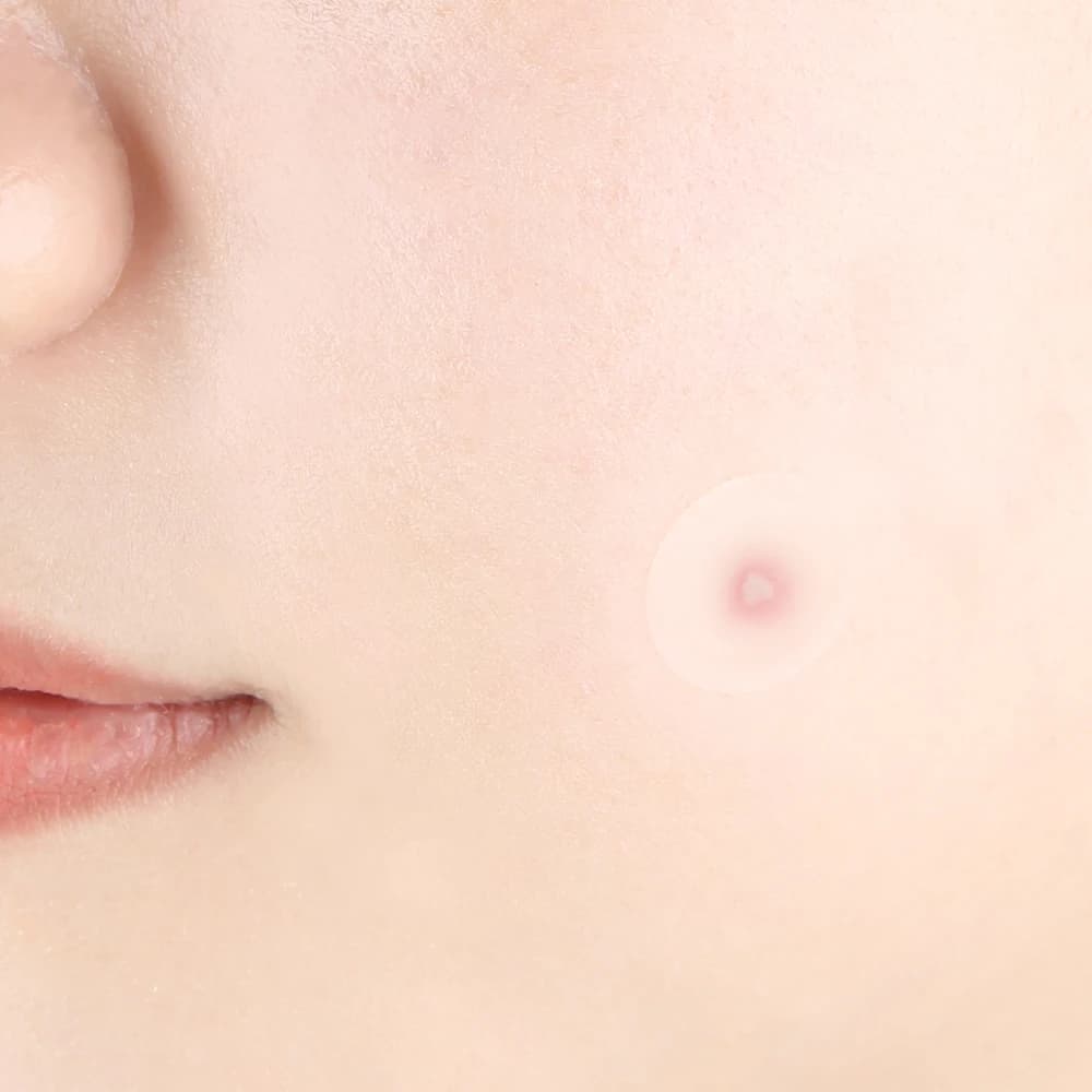 Clear Spot Patch, 72ea - Image 3