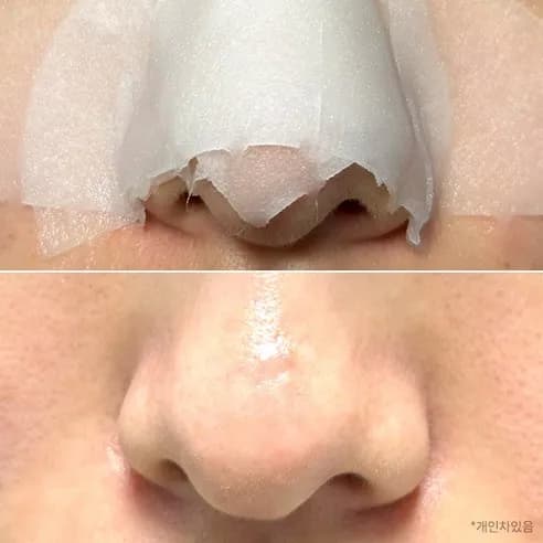 Salicylic Pore Trouble Melting Pad, 30ea - Image 2