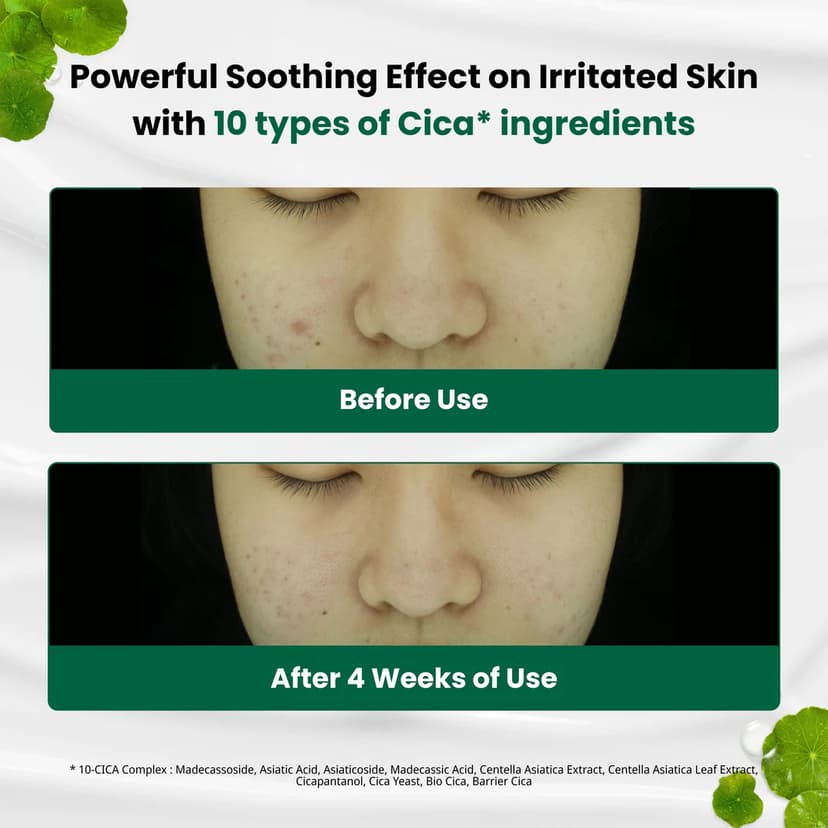 R.E.D Blemish Clear Soothing Cream, 70ml - Image 3