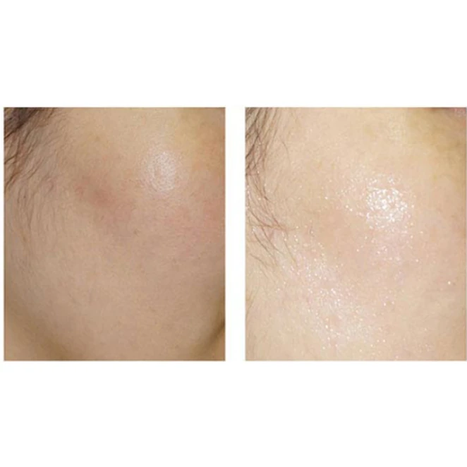 Houttuynia Cordata Mask Sheet - Image 3