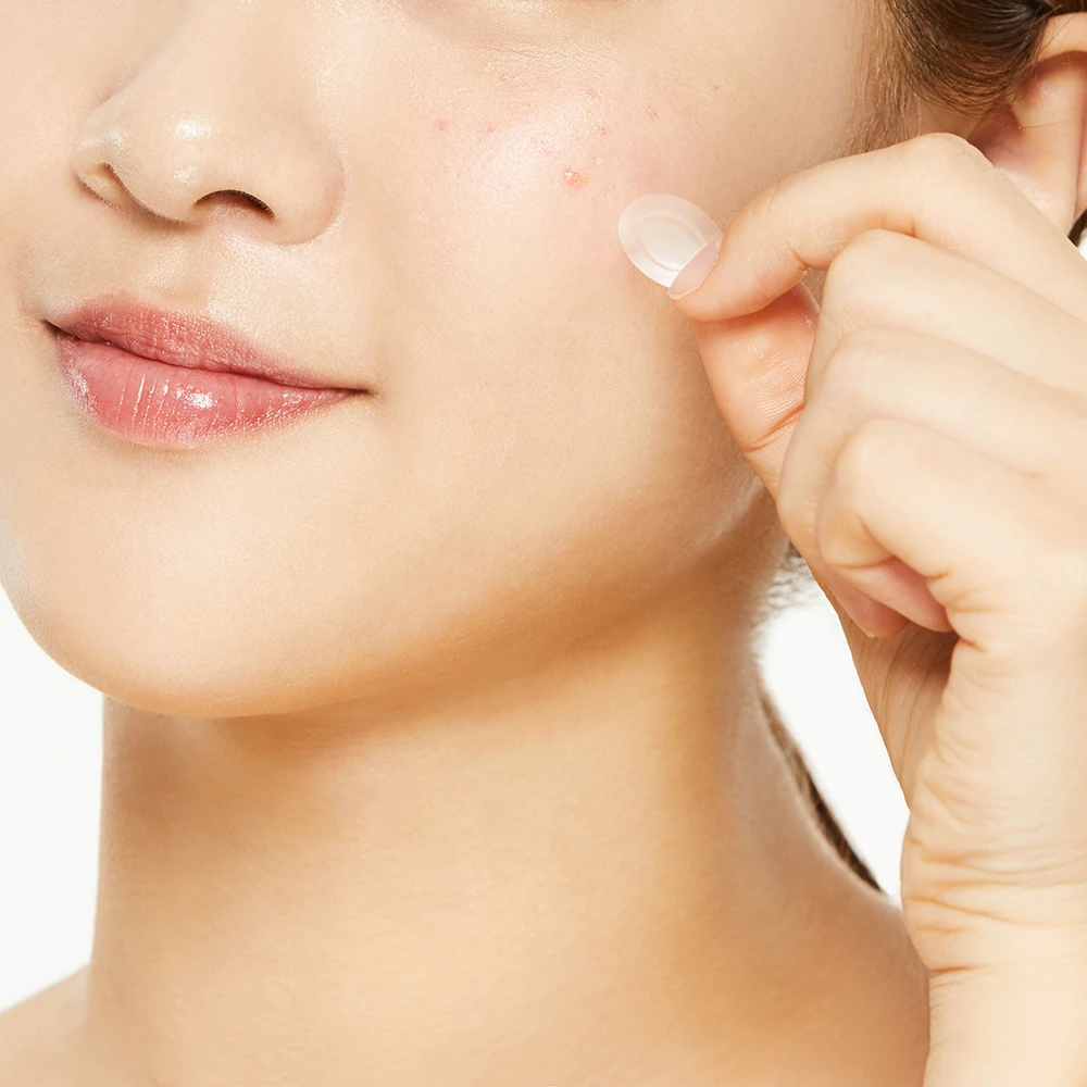 AC Collection Acne Patch - Image 4