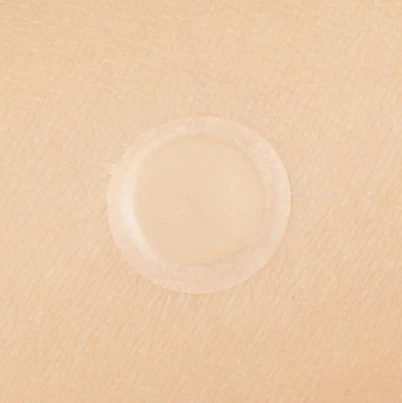 Spot Patch - Image 4