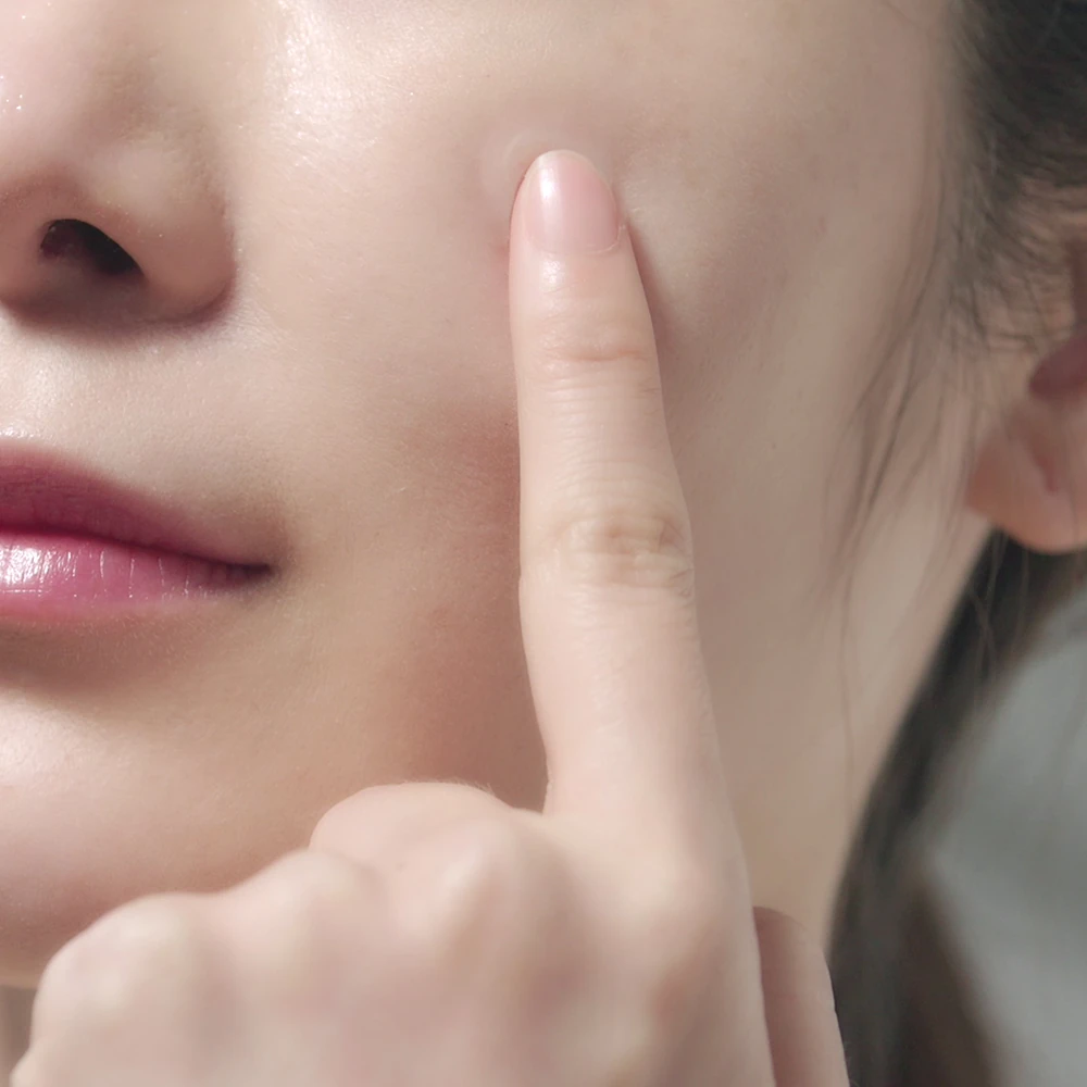 Calming Clear Spot Patch (Slim Care) - Image 3