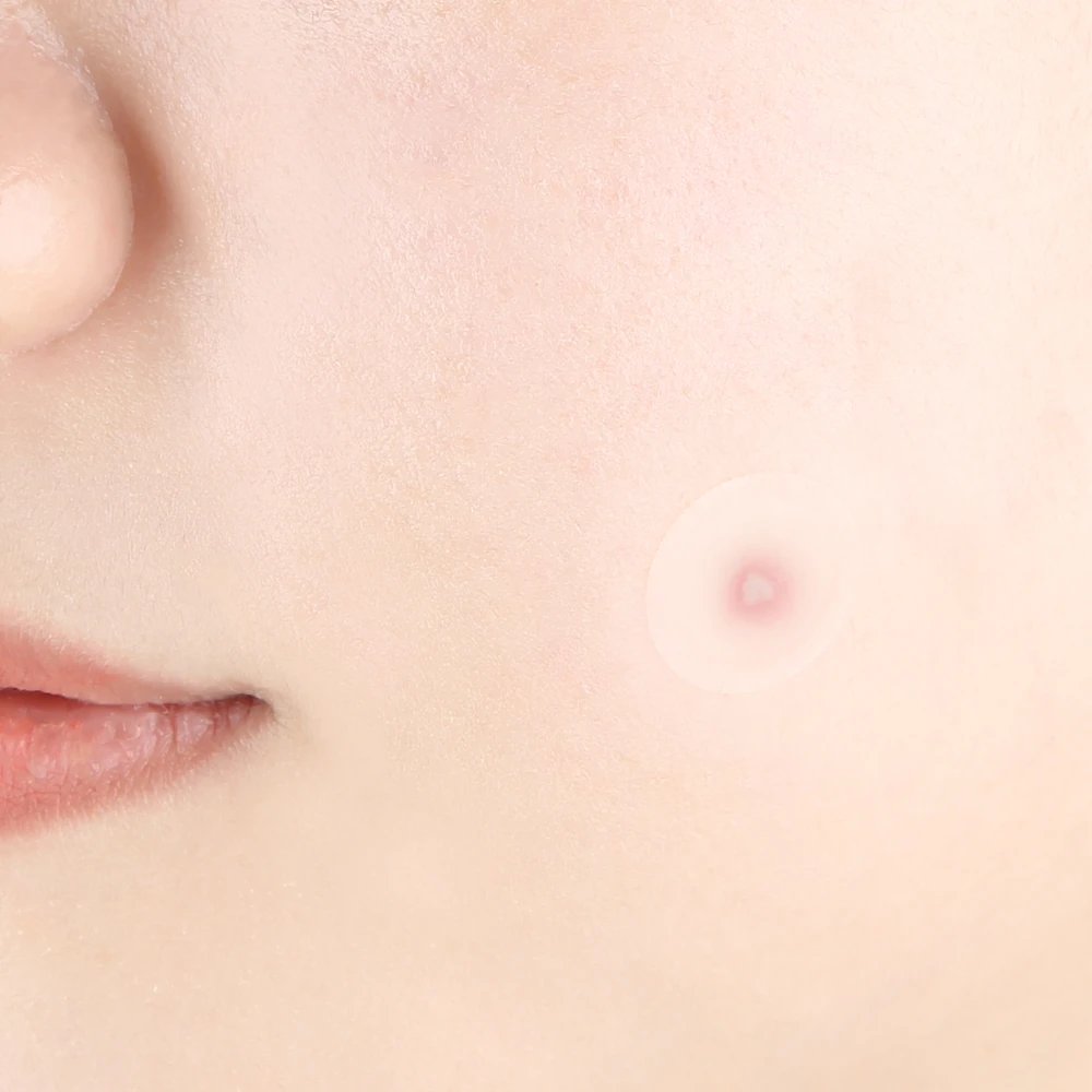 Clear Spot Patch - Image 3