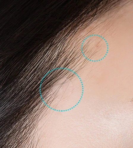 Blemish All Clear Patch - Image 4