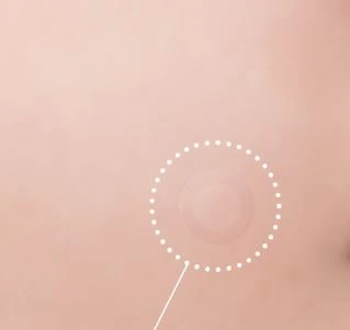 Skin Guard Plus Clear Patch - Image 5