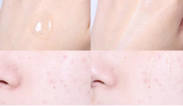 Derma Relief Balancing Skin - Image 2