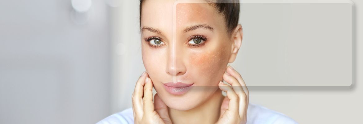 Korean moisturizers for redness-prone skin