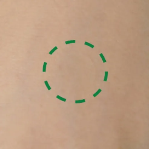 Heartleaf ACpair Spot Patch - Image 3